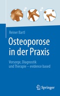Cover: Osteoporose in der Praxis - Springer