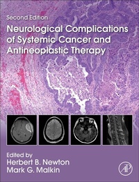 Abbildung von: Neurological Complications of Systemic Cancer and Antineoplastic Therapy - Academic Press