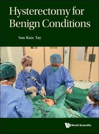 Abbildung von: Hysterectomy For Benign Conditions - World Scientific Publishing Co Pte Ltd