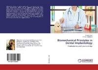 Abbildung von: Biomechanical Principles in Dental Implantology - LAP Lambert Academic Publishing