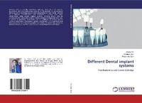 Abbildung von: Different Dental implant systems - LAP Lambert Academic Publishing