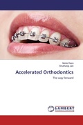 Cover: Accelerated Orthodontics - LAP Lambert Academic Publishing