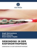 Cover: DEBONDING IN DER KIEFERORTHOP&Auml;DIE - Verlag Unser Wissen
