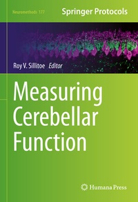 Abbildung von: Measuring Cerebellar Function - Springer