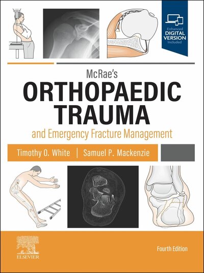 Abbildung von: McRae's Orthopaedic Trauma and Emergency Fracture Management E-Book - Elsevier