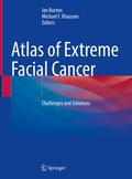 Cover: Atlas of Extreme Facial Cancer - Springer