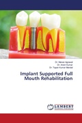 Cover: Implant Supported Full Mouth Rehabilitation - LAP Lambert Academic Publishing
