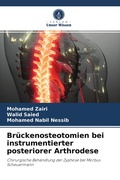 Cover: Brueckenosteotomien bei instrumentierter posteriorer Arthrodese - Verlag Unser Wissen