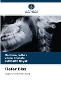 Cover: Tiefer Biss - Verlag Unser Wissen