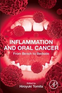Bild: Inflammation and Oral Cancer - Academic Press