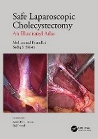 Enlarge image Cover: Safe Laparoscopic Cholecystectomy - CRC Press