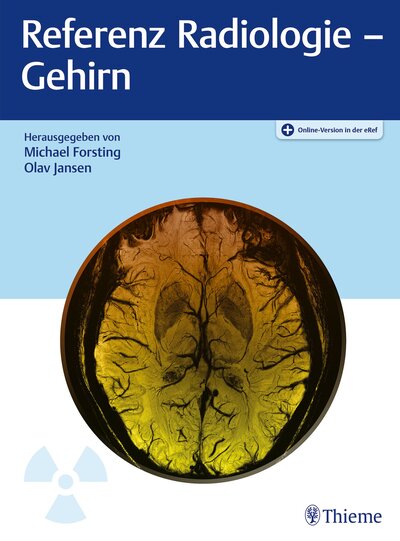 Abbildung von: Referenz Radiologie - Gehirn - Thieme