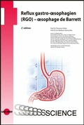 Cover: Reflux gastro-oesophagien (RGO) - oesophage de Barrett - UNI-MED Verlag AG