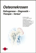 Cover: Osteonekrosen. Pathogenese - Diagnostik - Therapie - Verlauf - UNI-MED Verlag AG