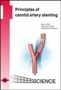 Cover: Principles of carotid artery stenting - UNI-MED Verlag AG