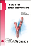 Cover: Principles of carotid artery stenting - UNI-MED
