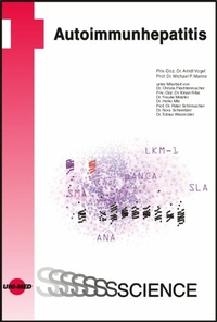 Abbildung von: Autoimmunhepatitis - UNI-MED Verlag AG