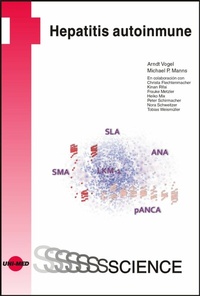 Abbildung von: Hepatitis autoinmune - UNI-MED Verlag AG