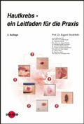 Cover: Hautkrebs - ein Leitfaden f&uuml;r die Praxis - UNI-MED Verlag AG