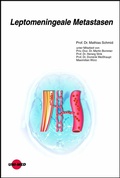Cover: Leptomeningeale Metastasen - UNI-MED Verlag AG
