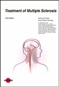 Cover: Treatment of Multiple Sclerosis - UNI-MED Verlag AG