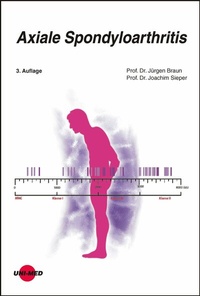 Bild vergrößern Bild: Axiale Spondyloarthritis - UNI-MED Verlag AG