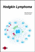 Cover: Hodgkin Lymphoma - UNI-MED Verlag AG