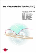 Cover: Die vitreomakul&auml;re Traktion (VMT) - UNI-MED Verlag AG