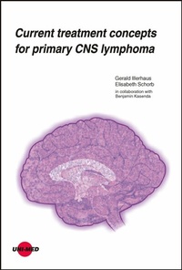 Abbildung von: Current treatment concepts for primary CNS lymphoma - UNI-MED Verlag AG
