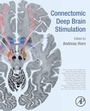 Cover: Connectomic Deep Brain Stimulation - Academic Press