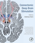 Abbildung von: Connectomic Deep Brain Stimulation - Academic Press