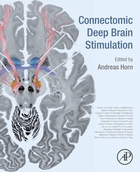 Abbildung von: Connectomic Deep Brain Stimulation - Academic Press