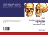 Abbildung von: TMJ ANKYLOSIS: Overview and its Surgical Management - LAP Lambert Academic Publishing