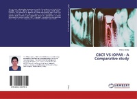Abbildung von: CBCT VS IOPAR - A Comparative study - LAP Lambert Academic Publishing