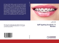 Abbildung von: Self ligating brackets: A Review - LAP Lambert Academic Publishing