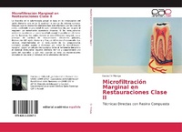 Abbildung von: Microfiltración Marginal en Restauraciones Clase II - Editorial Académica Española
