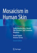 Cover: Mosaicism in Human Skin - Springer