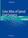 Abbildung von: Color Atlas of Spinal Cord Surgery - Springer