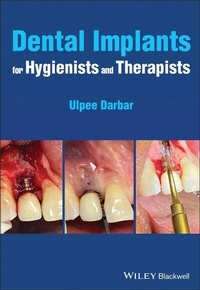 Abbildung von: Dental Implants for Hygienists and Therapists - Wiley