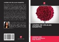 Cover: Lesoes de Celulas Gigantes - Edicoes Nosso Conhecimento