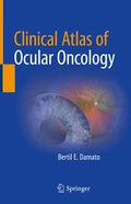 Cover: Clinical Atlas of Ocular Oncology - Springer