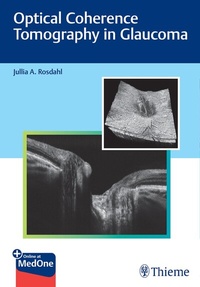 Abbildung von: Optical Coherence Tomography in Glaucoma - Thieme Publishers