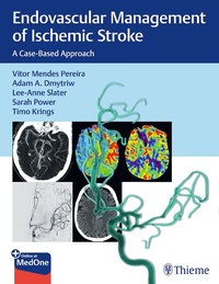 Abbildung von: Endovascular Management of Ischemic Stroke - Thieme Publishers