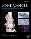 Bild: Bone Cancer - Academic Press