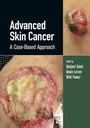 Cover: Advanced Skin Cancer - CRC Press