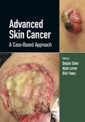 Cover: Advanced Skin Cancer - CRC Press