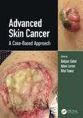 Cover: Advanced Skin Cancer - CRC Press