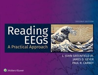 Abbildung von: Reading EEGs: A Practical Approach - Wolters Kluwer Health