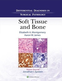 Abbildung von: Differential Diagnoses in Surgical Pathology: Soft Tissue and Bone - Wolters Kluwer Health