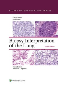 Abbildung von: Biopsy Interpretation of the Lung - Wolters Kluwer Health